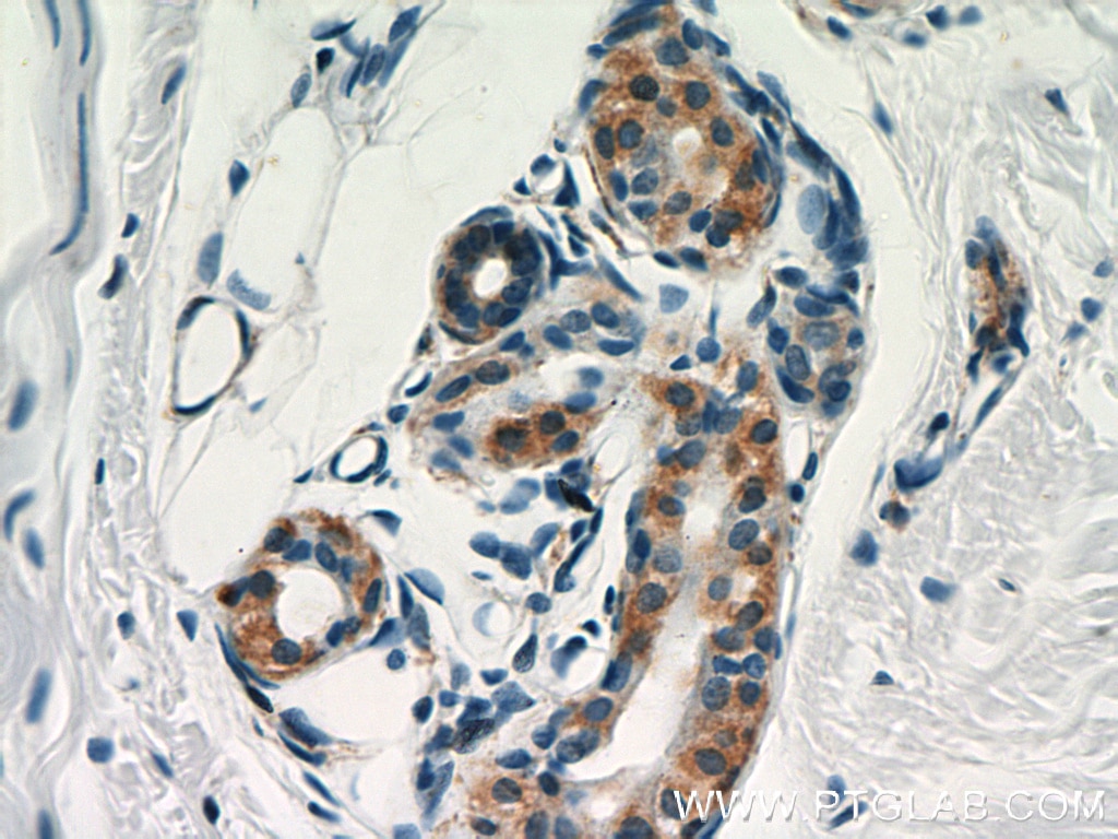 Immunohistochemistry (IHC) staining of human skin tissue using CNN3 Polyclonal antibody (11509-1-AP)