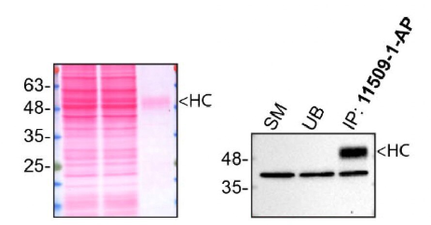 Immunoprecipitation (IP) experiment of U-87MG cells using CNN3 Polyclonal antibody (11509-1-AP)