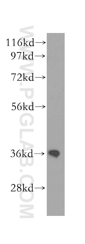 Western Blot (WB) analysis of human kidney tissue using CNN3 Polyclonal antibody (11509-1-AP)