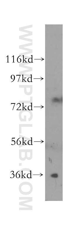 Western Blot (WB) analysis of human skeletal muscle tissue using CNN3 Polyclonal antibody (11509-1-AP)