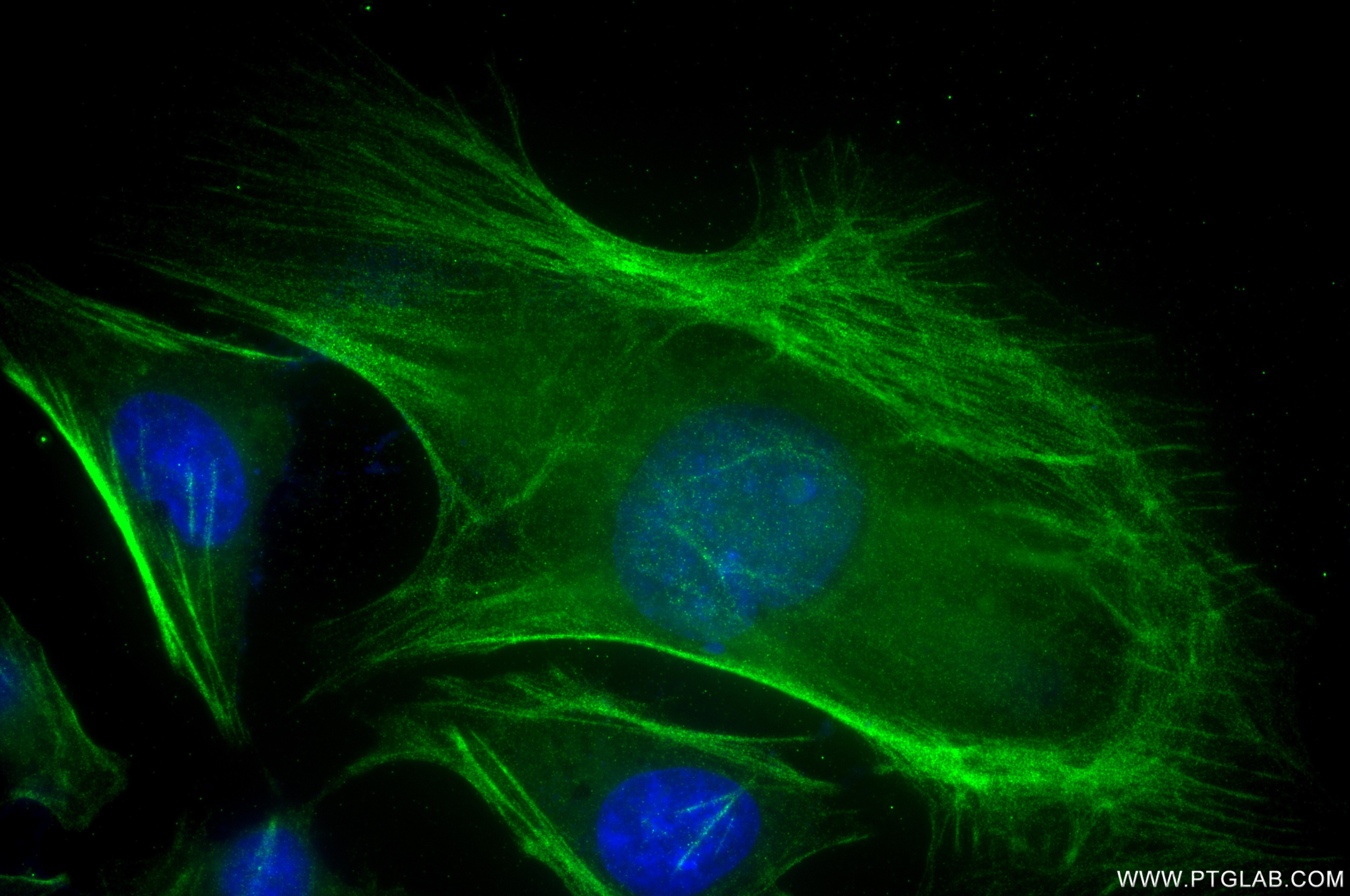 Immunofluorescence (IF) / fluorescent staining of HeLa cells using CNN3 Recombinant monoclonal antibody (86550-3-RR)