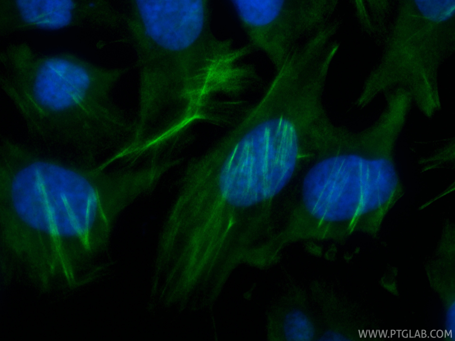 Immunofluorescence (IF) / fluorescent staining of HeLa cells using CoraLite® Plus 488-conjugated CNN3 Recombinant mon (CL488-86550-3)