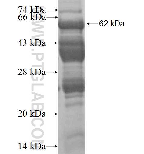 CNN3 fusion protein Ag2068 SDS-PAGE