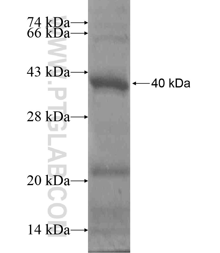 CNNM1 fusion protein Ag17221 SDS-PAGE