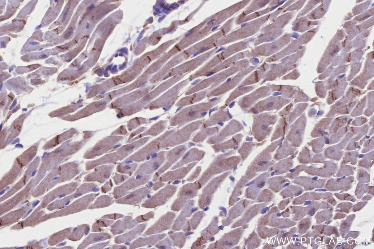 IHC staining of mouse heart using 13976-1-AP Immunohistochemistry (IHC) staining of mouse heart tissue using CNNM3 Polyclonal antibody (13976-1-AP)