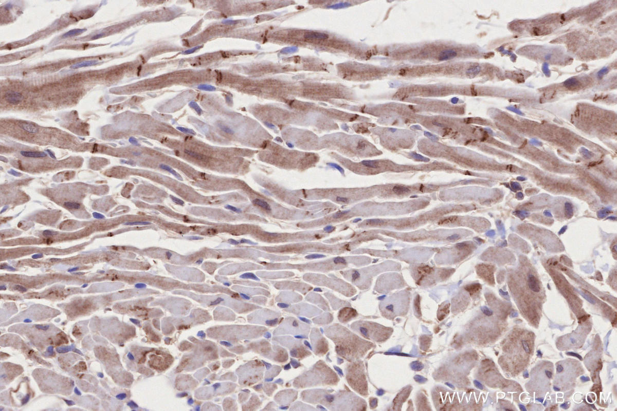 IHC staining of rat heart using 13976-1-AP Immunohistochemistry (IHC) staining of rat heart tissue using CNNM3 Polyclonal antibody (13976-1-AP)