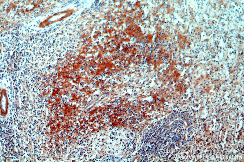 Immunohistochemistry (IHC) staining of human spleen tissue using CNNM3 Polyclonal antibody (13976-1-AP)