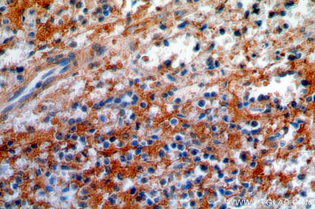 IHC staining of human spleen using 13976-1-AP