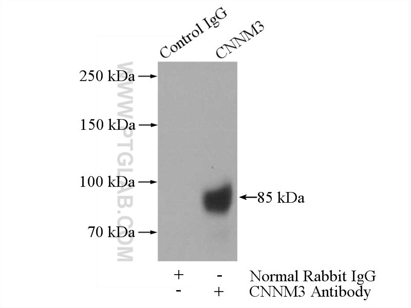 Immunoprecipitation (IP) experiment of K-562 cells using CNNM3 Polyclonal antibody (13976-1-AP)