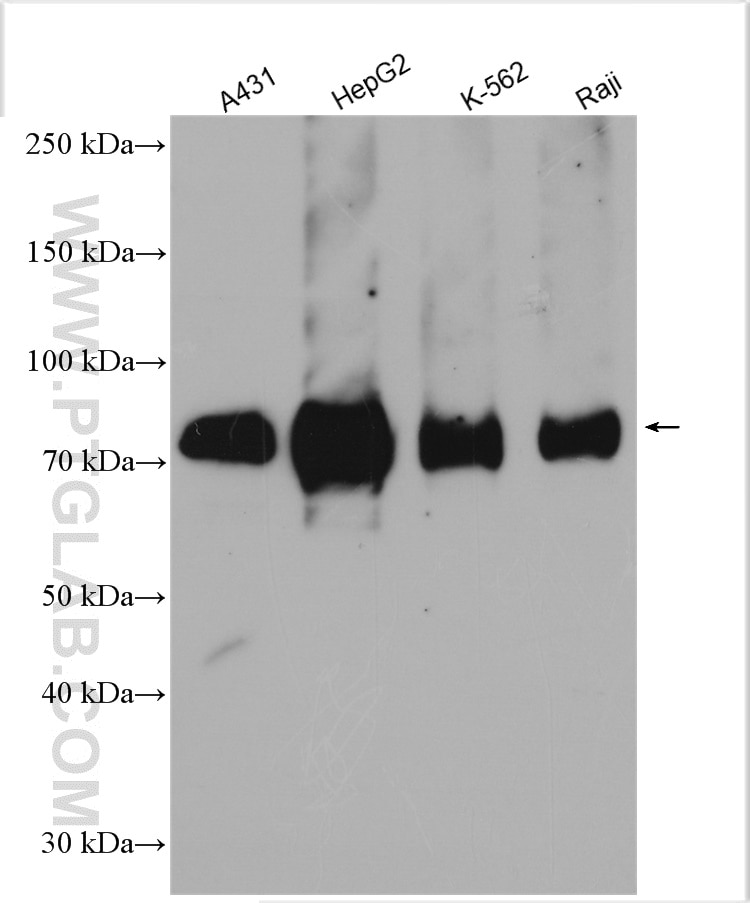 Western Blot (WB) analysis of various lysates using CNNM3 Polyclonal antibody (13976-1-AP)