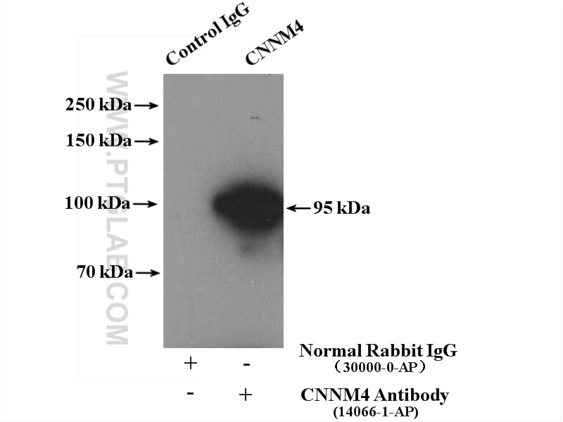 Immunoprecipitation (IP) experiment of mouse testis tissue using CNNM4 Polyclonal antibody (14066-1-AP)