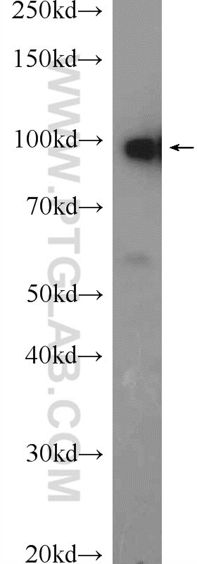 Western Blot (WB) analysis of mouse testis tissue using CNNM4 Polyclonal antibody (14066-1-AP)