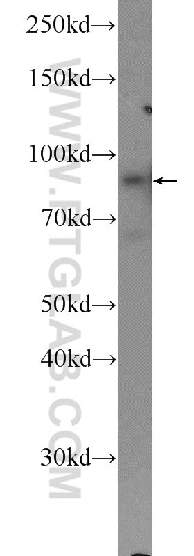 Western Blot (WB) analysis of HEK-293 cells using CNNM4 Polyclonal antibody (14066-1-AP)