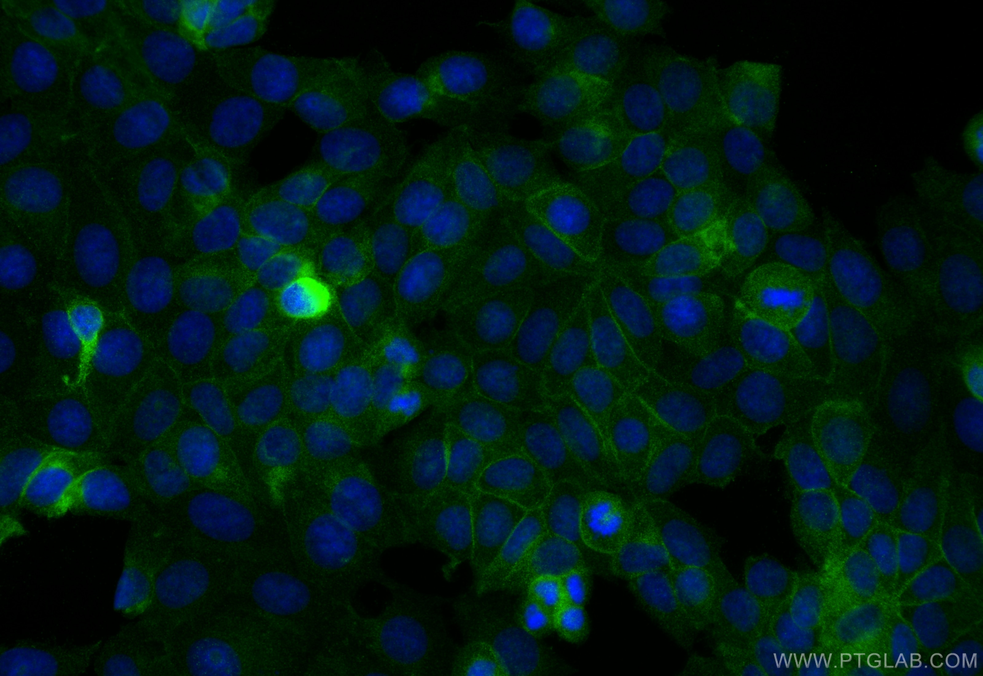Immunofluorescence (IF) / fluorescent staining of MCF-7 cells using CNNM4 Recombinant antibody (83824-5-RR)