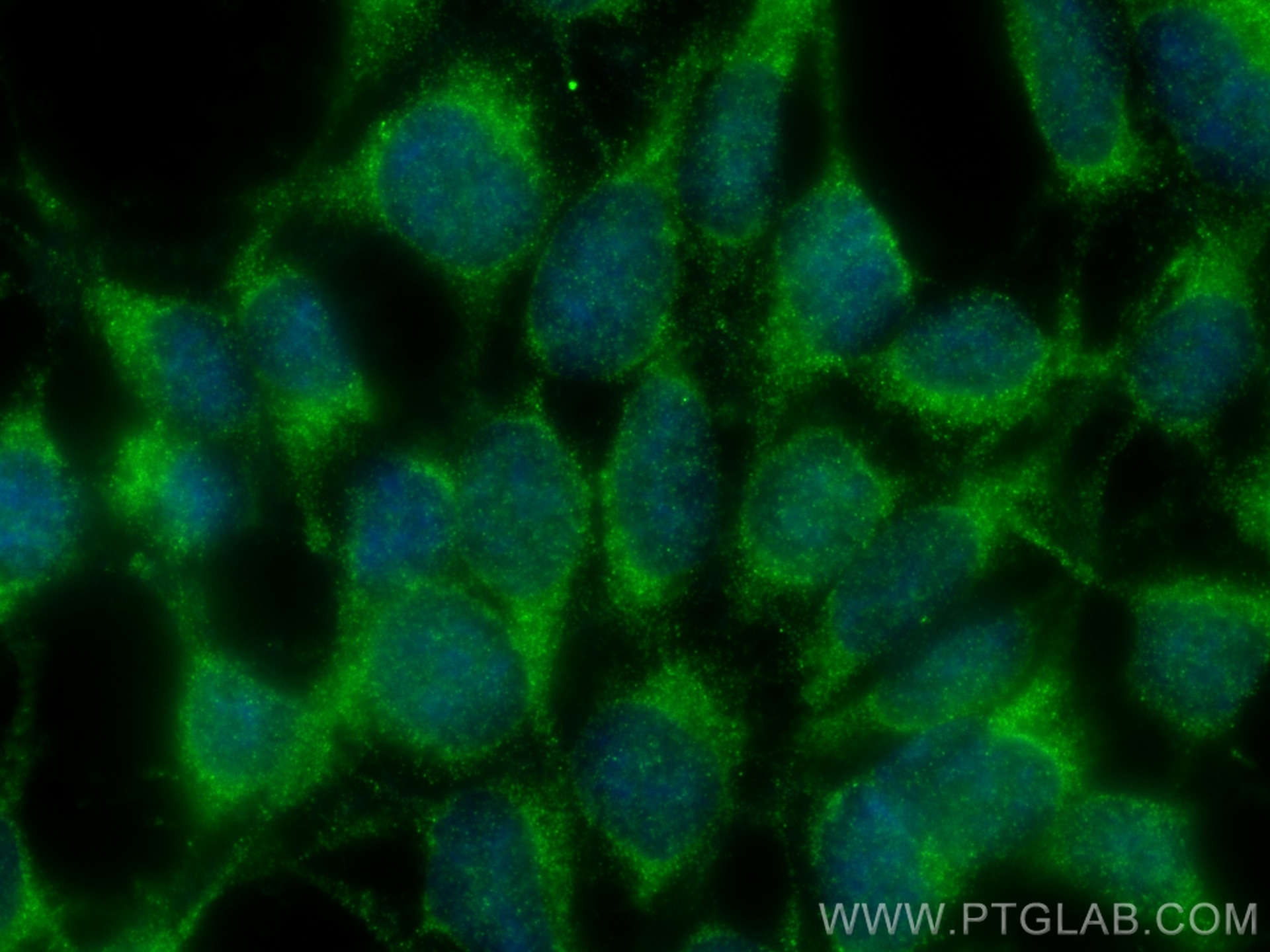 Immunofluorescence (IF) / fluorescent staining of HEK-293 cells using CNOT1 Polyclonal antibody (14276-1-AP)