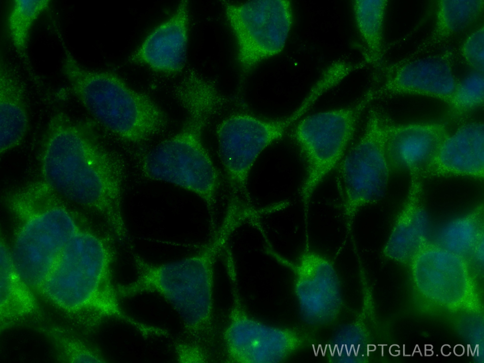 Immunofluorescence (IF) / fluorescent staining of HEK-293 cells using CNOT1 Polyclonal antibody (14276-1-AP)
