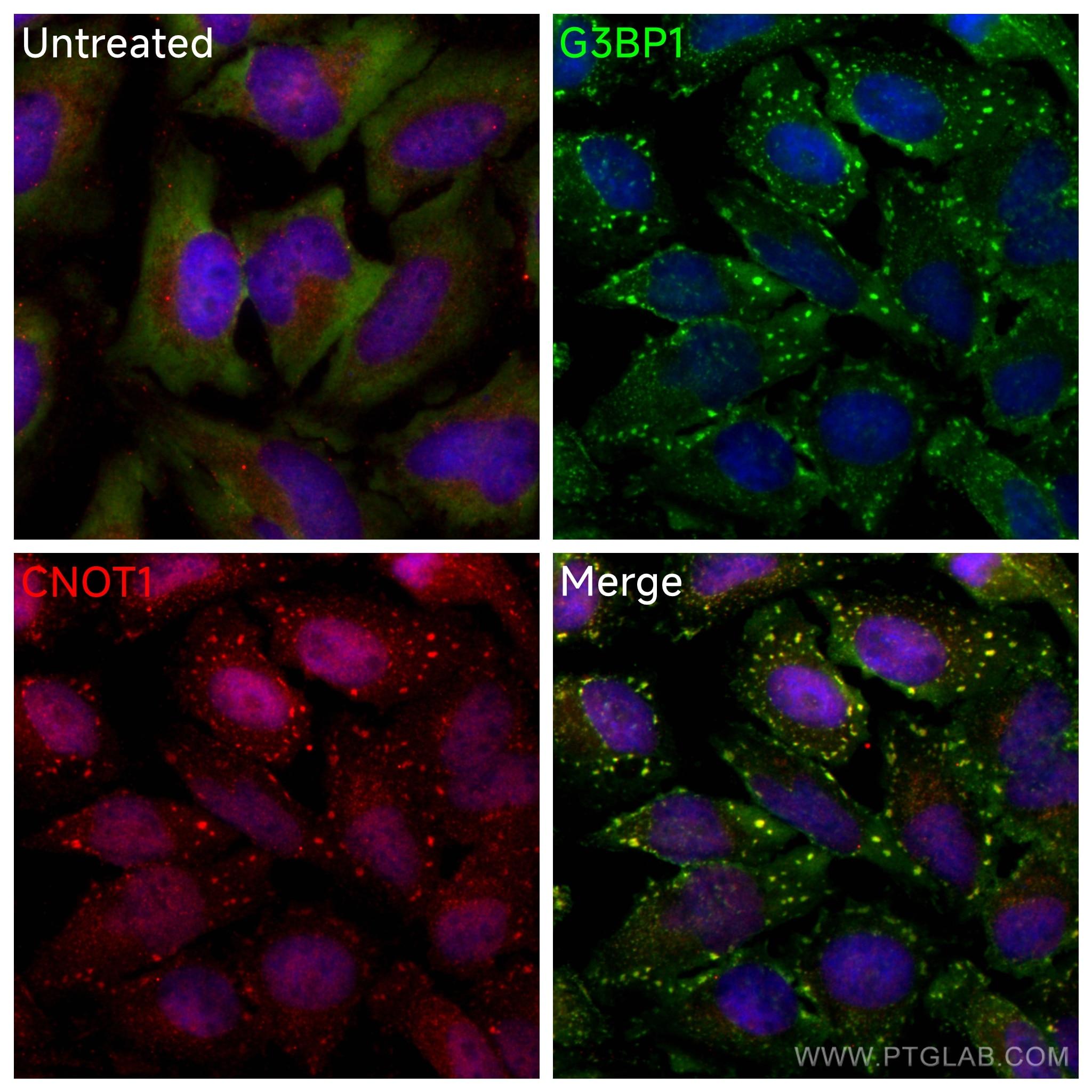 Immunofluorescence (IF) / fluorescent staining of HeLa cells using CNOT1 Polyclonal antibody (14276-1-AP)