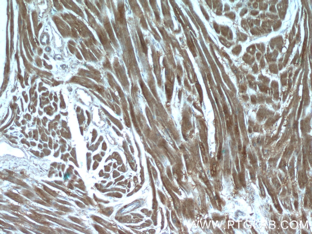 Immunohistochemistry (IHC) staining of human heart tissue using CNOT1 Polyclonal antibody (14276-1-AP)