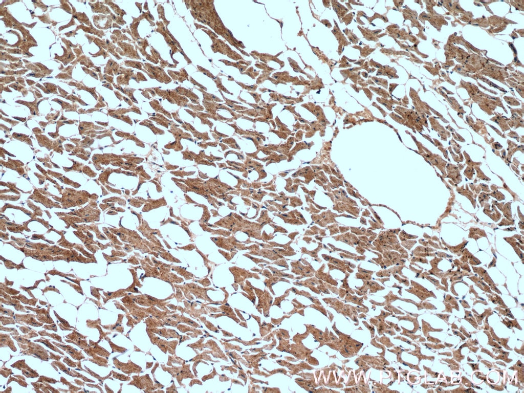 Immunohistochemistry (IHC) staining of human heart tissue using CNOT1 Polyclonal antibody (14276-1-AP)