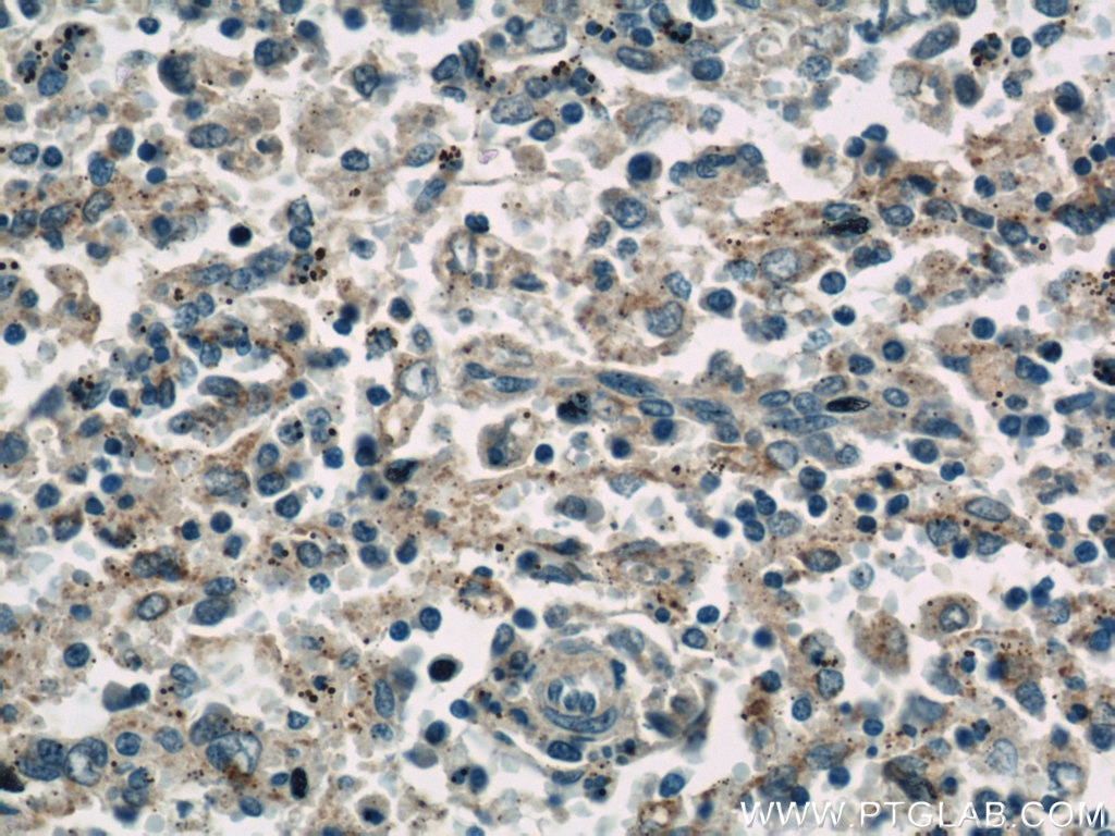 Immunohistochemistry (IHC) staining of human spleen tissue using CNOT1 Polyclonal antibody (14276-1-AP)