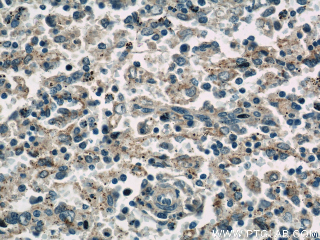 IHC staining of human spleen using 14276-1-AP