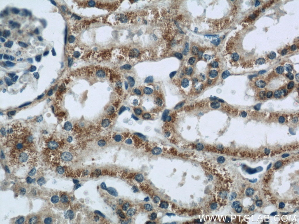 Immunohistochemistry (IHC) staining of human kidney tissue using CNOT1 Polyclonal antibody (14276-1-AP)