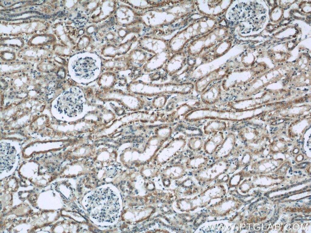 Immunohistochemistry (IHC) staining of human kidney tissue using CNOT1 Polyclonal antibody (14276-1-AP)