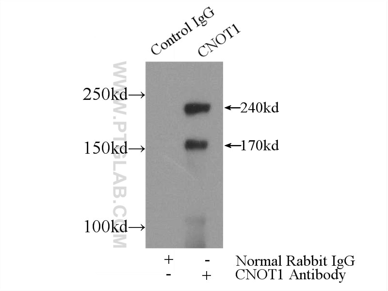 Immunoprecipitation (IP) experiment of mouse kidney tissue using CNOT1 Polyclonal antibody (14276-1-AP)