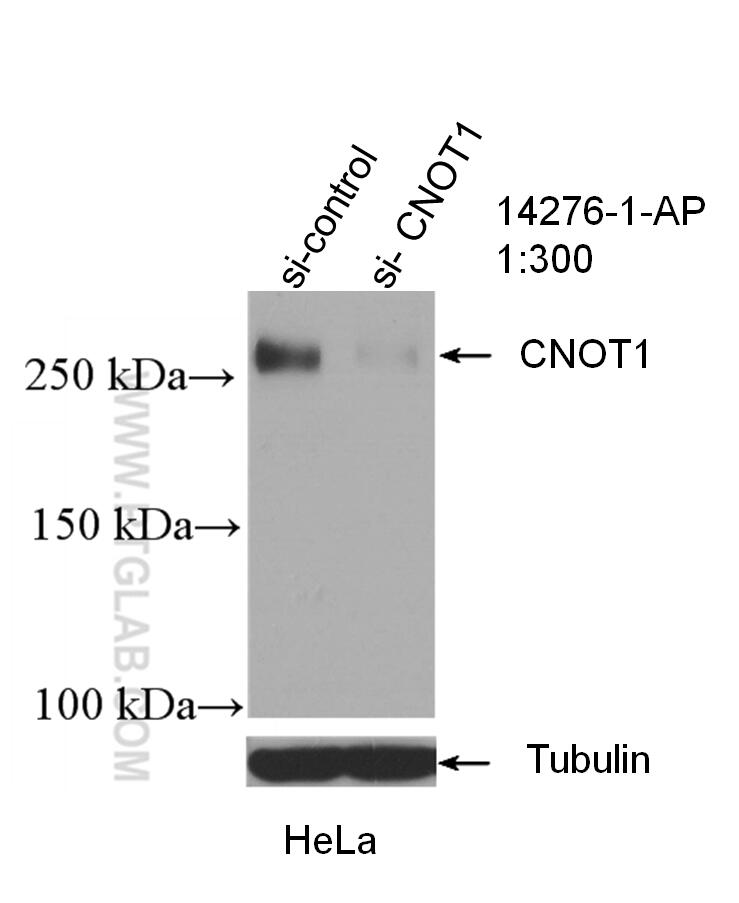 Western Blot (WB) analysis of HeLa cells using CNOT1 Polyclonal antibody (14276-1-AP)