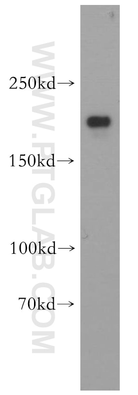 Western Blot (WB) analysis of human brain tissue using CNOT1 Polyclonal antibody (14276-1-AP)