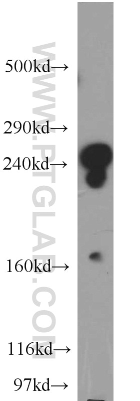 Western Blot (WB) analysis of mouse kidney tissue using CNOT1 Polyclonal antibody (14276-1-AP)