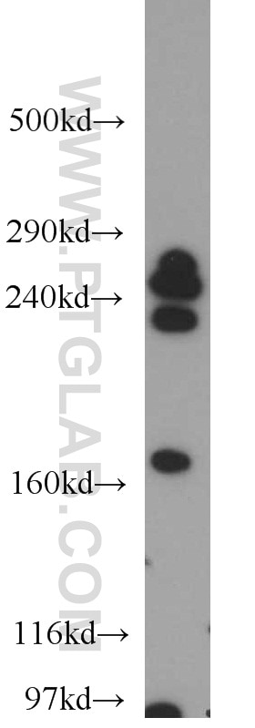 Western Blot (WB) analysis of mouse spleen tissue using CNOT1 Polyclonal antibody (14276-1-AP)