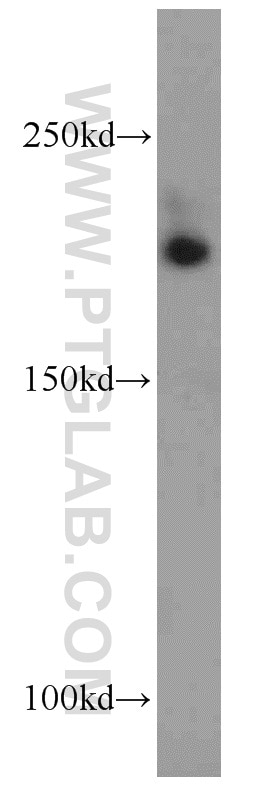 Western Blot (WB) analysis of mouse thymus tissue using CNOT1 Polyclonal antibody (14276-1-AP)