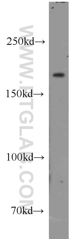 Western Blot (WB) analysis of mouse kidney tissue using CNOT1 Polyclonal antibody (14276-1-AP)