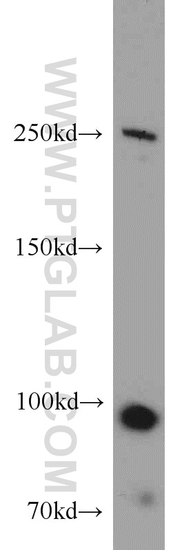 WB analysis of HEK-293 using 14276-1-AP