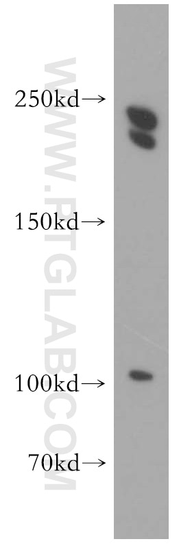 Western Blot (WB) analysis of mouse brain tissue using CNOT1 Polyclonal antibody (14276-1-AP)