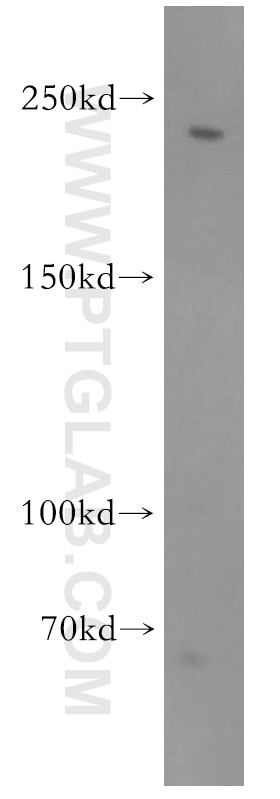 WB analysis of mouse heart using 14276-1-AP