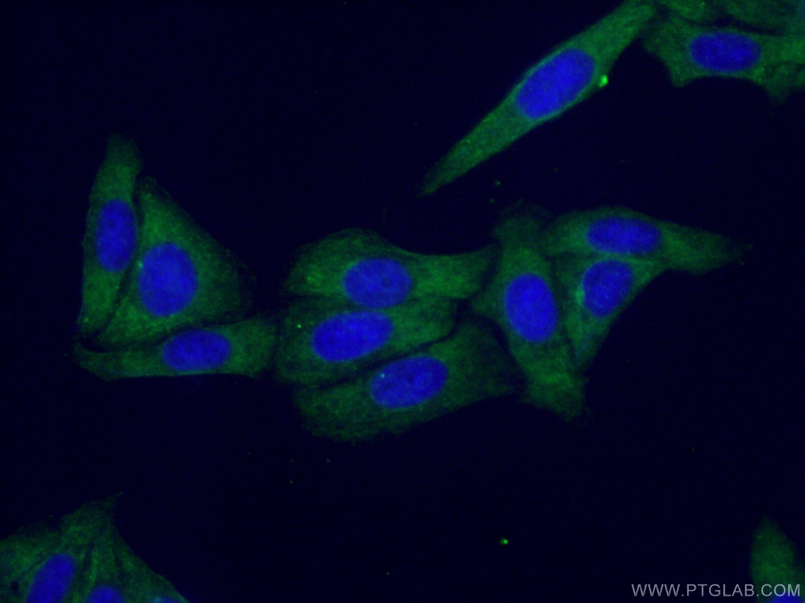 Immunofluorescence (IF) / fluorescent staining of HepG2 cells using CNOT1 Monoclonal antibody (66507-1-Ig)
