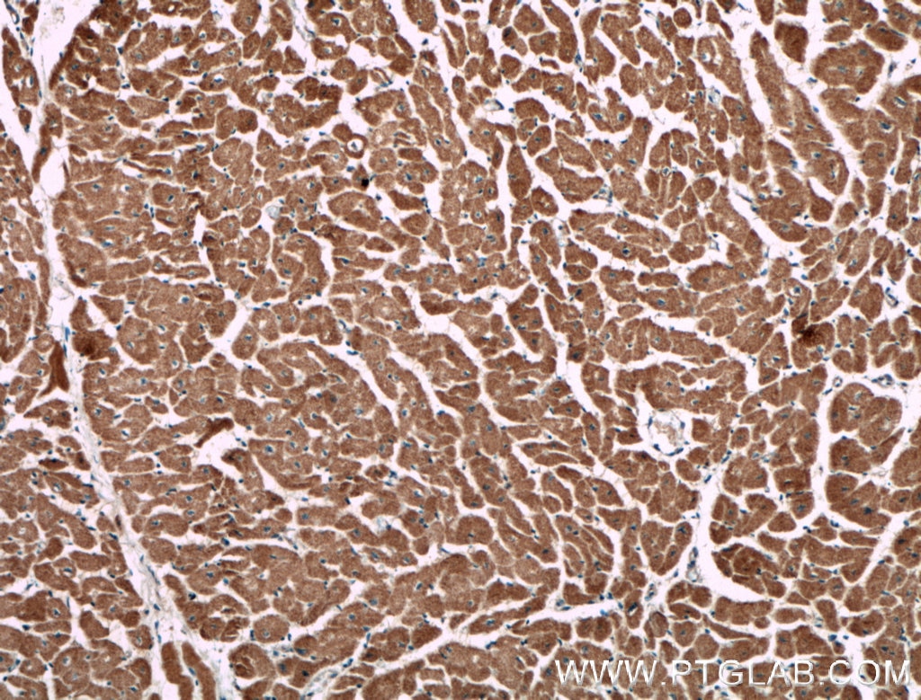Immunohistochemistry (IHC) staining of human heart tissue using CNOT1 Monoclonal antibody (66507-1-Ig)