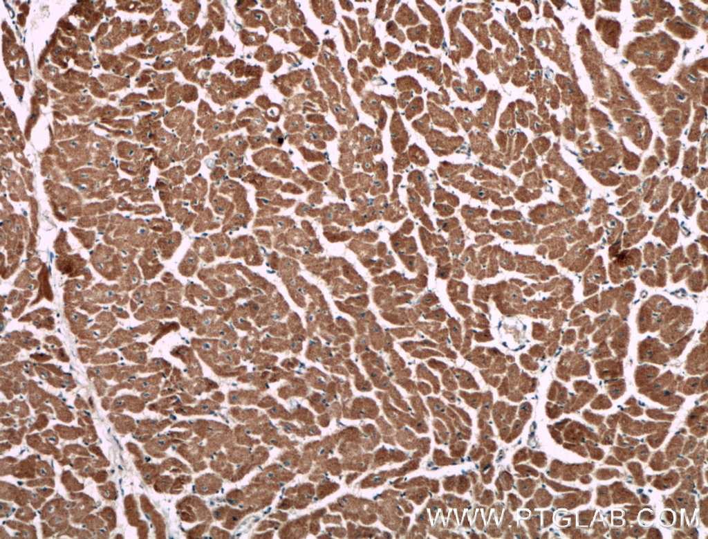 IHC staining of human heart using 66507-1-Ig