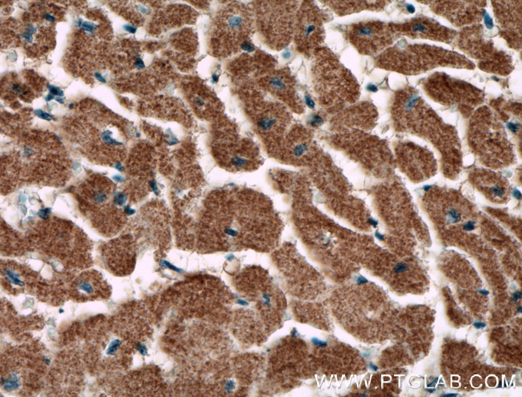 Immunohistochemistry (IHC) staining of human heart tissue using CNOT1 Monoclonal antibody (66507-1-Ig)