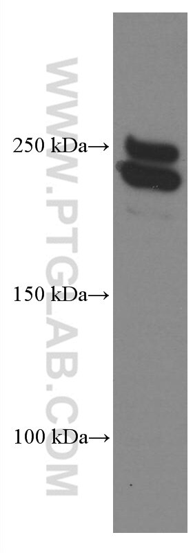 Western Blot (WB) analysis of HEK-293 cells using CNOT1 Monoclonal antibody (66507-1-Ig)