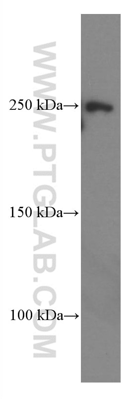 Western Blot (WB) analysis of human cerebellum tissue using CNOT1 Monoclonal antibody (66507-1-Ig)