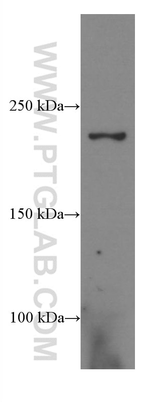 Western Blot (WB) analysis of mouse kidney tissue using CNOT1 Monoclonal antibody (66507-1-Ig)