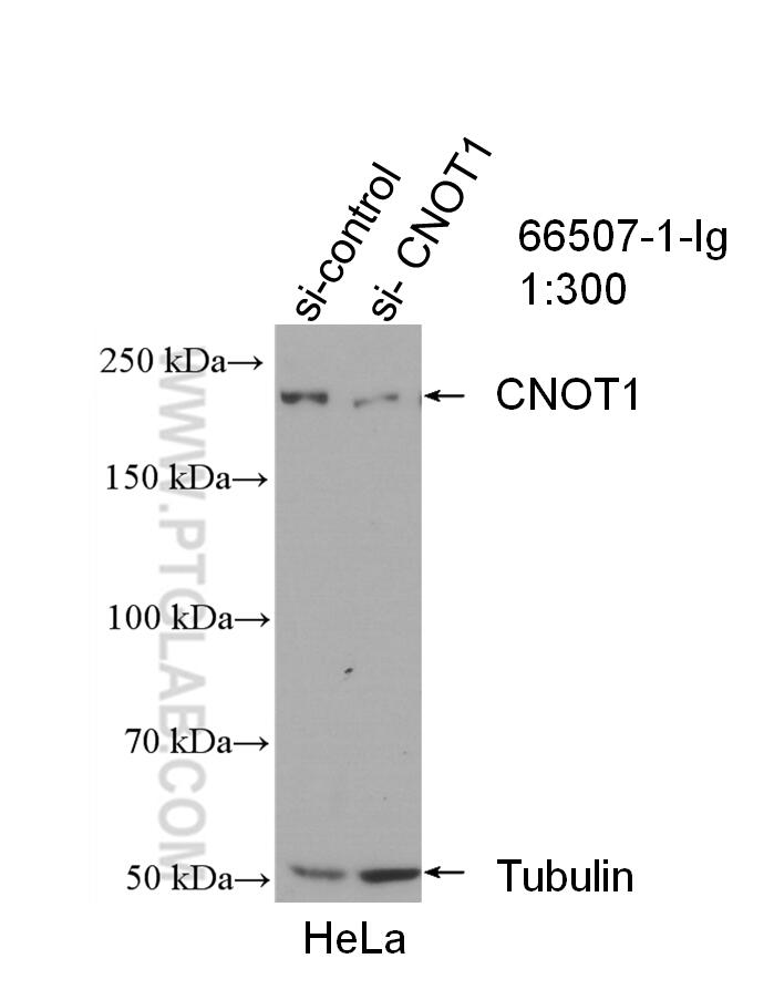 Western Blot (WB) analysis of HeLa cells using CNOT1 Monoclonal antibody (66507-1-Ig)