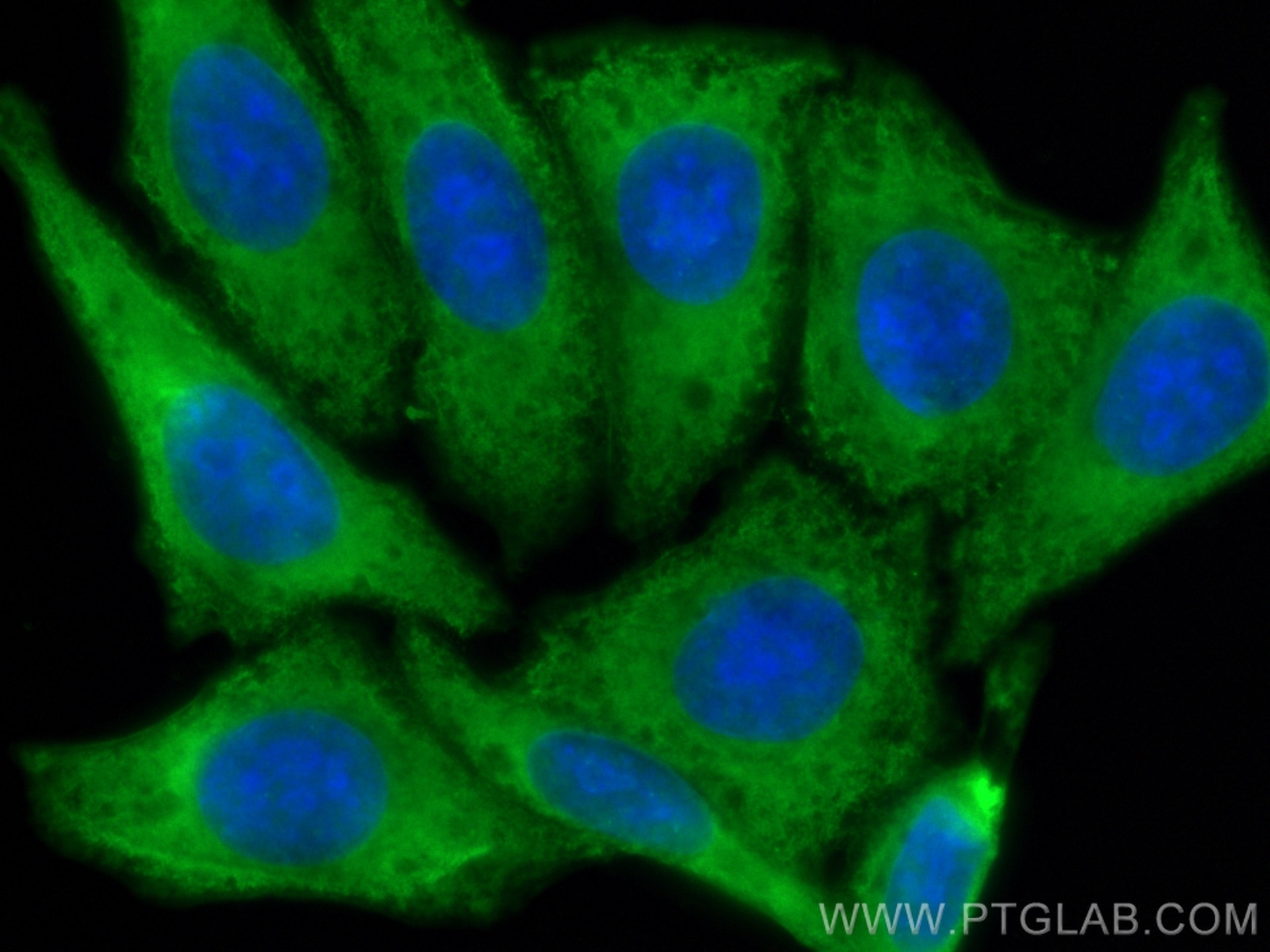 Immunofluorescence (IF) / fluorescent staining of HepG2 cells using CoraLite® Plus 488-conjugated CNOT1 Monoclonal ant (CL488-66507)