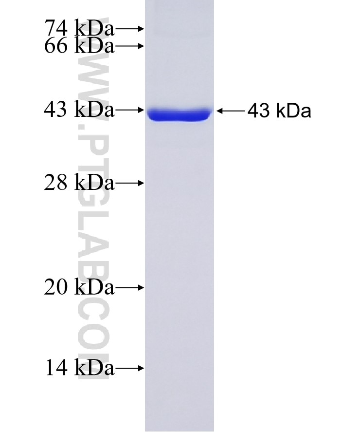 CNOT1 fusion protein Ag5623 SDS-PAGE