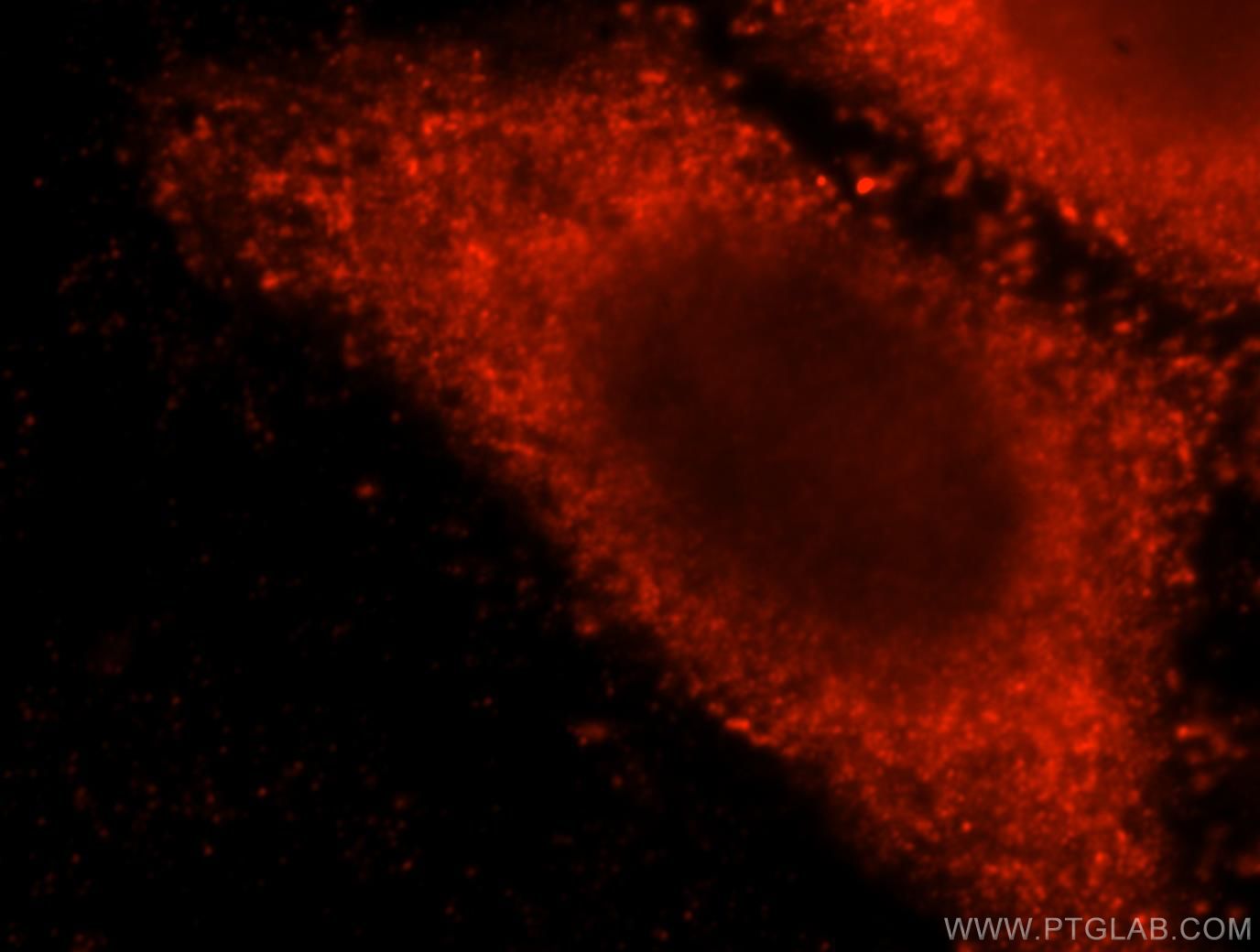 Immunofluorescence (IF) / fluorescent staining of HepG2 cells using CNOT10 Polyclonal antibody (15938-1-AP)