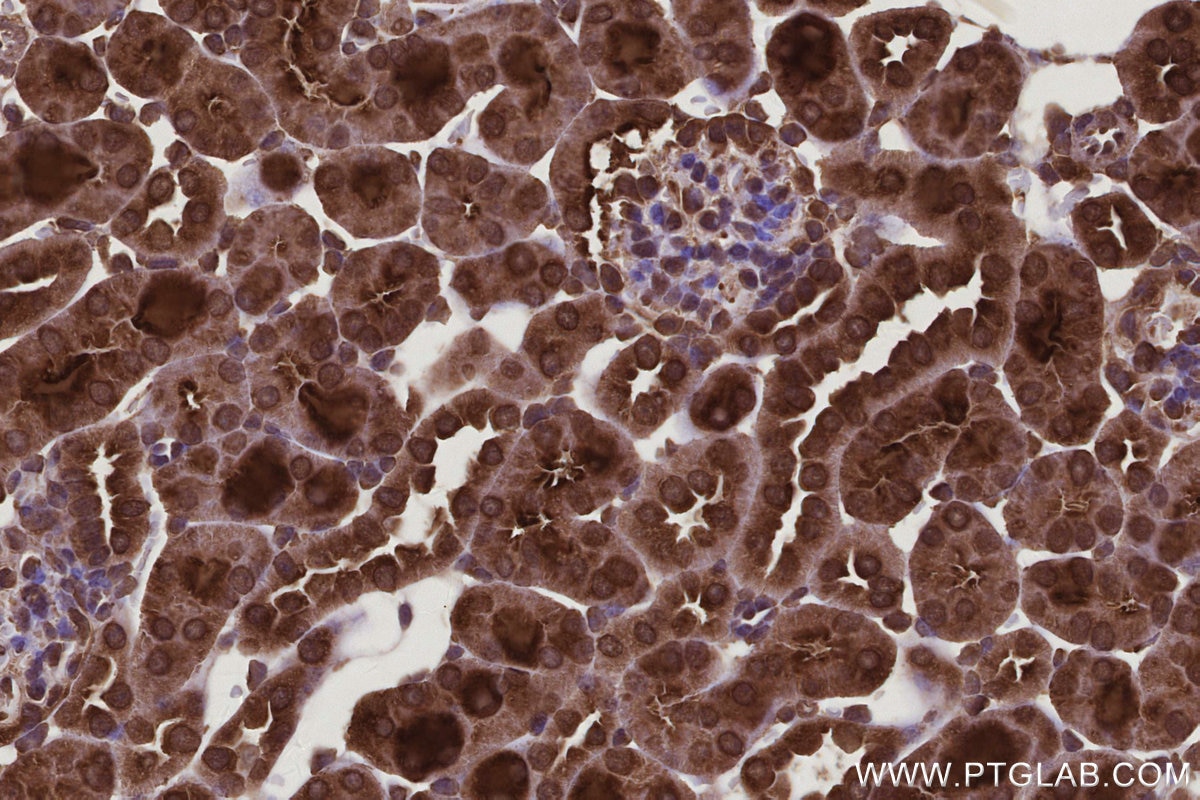 Immunohistochemistry (IHC) staining of mouse kidney tissue using CNOT10 Polyclonal antibody (15938-1-AP)
