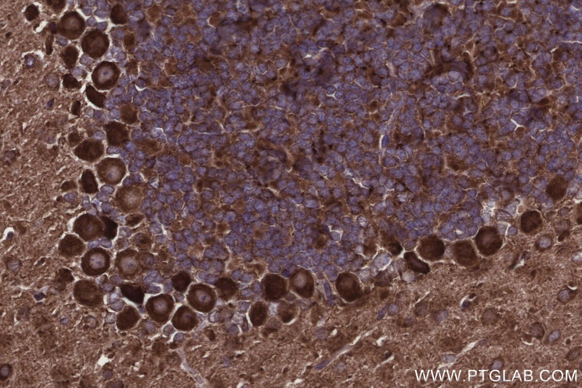 Immunohistochemistry (IHC) staining of mouse cerebellum tissue using CNOT10 Polyclonal antibody (15938-1-AP)